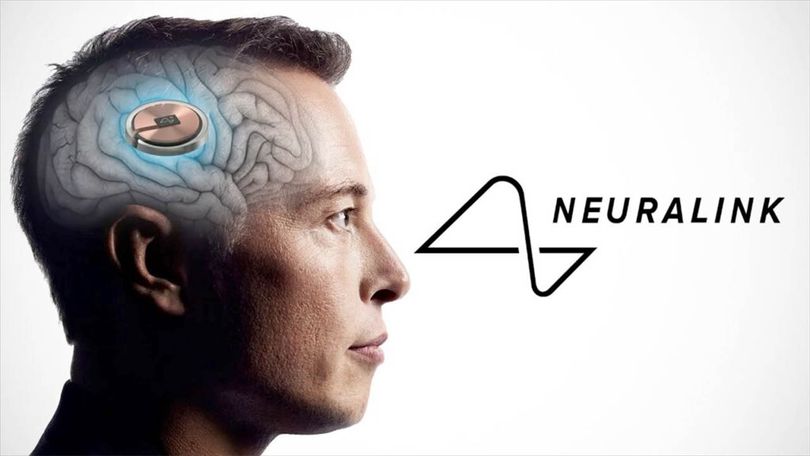 Neuralink