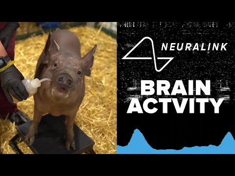 Neuralink's PRIME Study